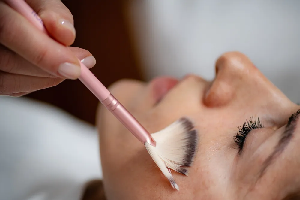 Como funciona o peeling químico?