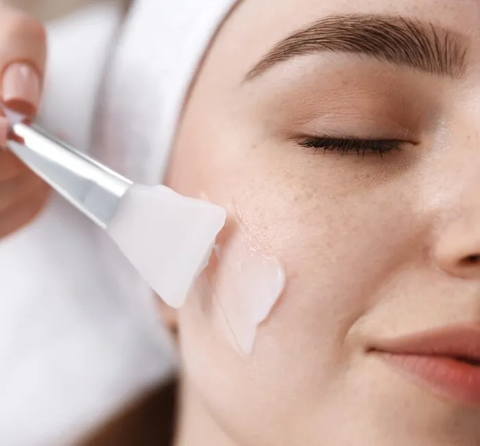 Peeling Químico em Natal